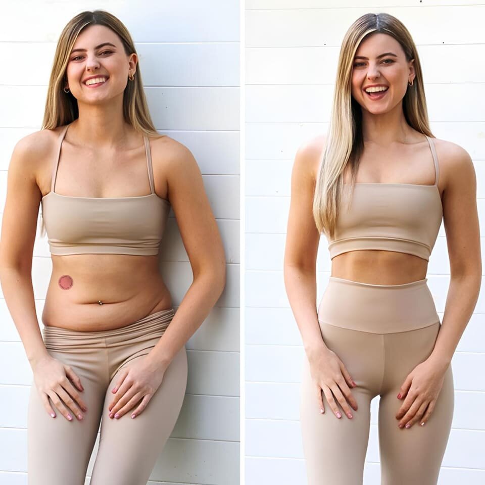 Glorenda Patches image